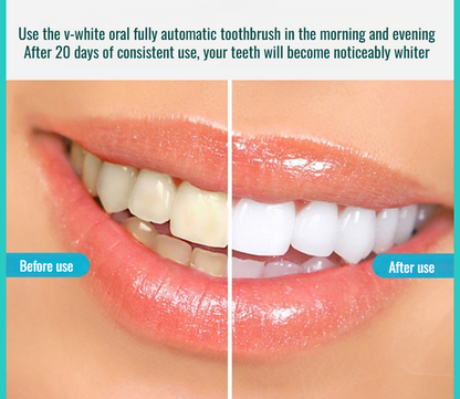 Fully Automatic U-Shaped Electric Toothbrush | 100% Washable + Ultrasonic Dental Flosser Combo